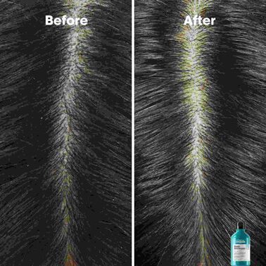스칼프 어드밴스드 - 로레알 프로페셔널 | L'Oréal 파트너샵
